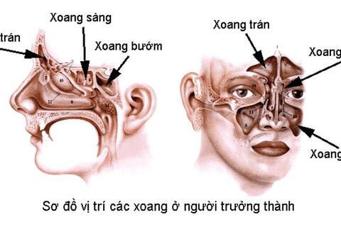 Viêm xoang sàng sau có nguy hiểm không?